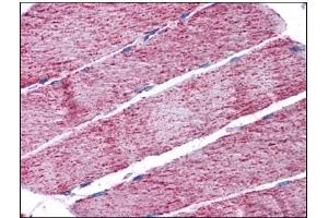 Human Skeletal Muscle: Formalin-Fixed, Paraffin-Embedded (FFPE) (FH 抗体  (Internal Region))