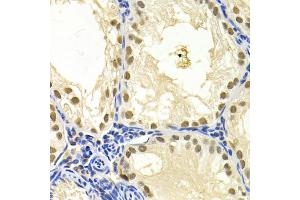 Immunohistochemistry of paraffin-embedded mouse testis using DDB1 Antibody (ABIN5971498) at dilution of 1/200 (40x lens). (DDB1 抗体)