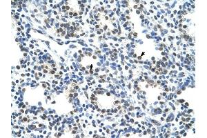 CBX3 antibody was used for immunohistochemistry at a concentration of 4-8 ug/ml to stain Alveolar cells (arrows) in Human Lung. (CBX3 抗体  (Middle Region))
