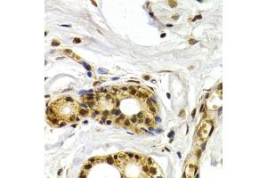 Immunohistochemistry of paraffin-embedded human mammary gland using ATF2 antibody (ABIN5971182) at dilution of 1/200 (40x lens). (ATF2 抗体)