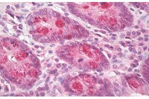 Image no. 1 for anti-Intestinal Cell (MAK-Like) Kinase (ICK) (AA 448-497) antibody (ABIN6749783) (ICK 抗体  (AA 448-497))