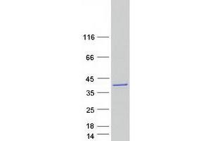 Western Blotting (WB) image for LIM and SH3 Protein 1 (LASP1) protein (Myc-DYKDDDDK Tag) (ABIN2724510)
