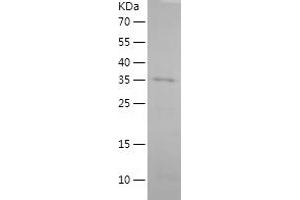 Somatostatin Protein (SST) (AA 1-116) (His-IF2DI Tag)