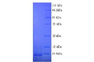 SDS-PAGE (SDS) image for Chemokine (C-C Motif) Ligand 8 (CCL8) (AA 24-99) protein (His tag) (ABIN5713326)