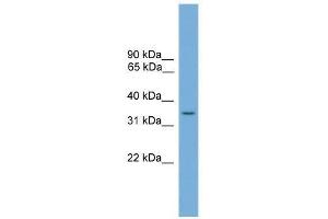 SLC35A4 antibody used at 0. (SLC35A4 抗体  (Middle Region))