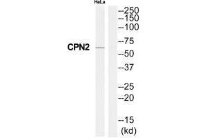 Western blot analysis of extracts from HeLa cells, using CPN2 antibody. (CPN2 抗体  (C-Term))