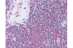 Anti-UBASH3A antibody IHC of human spleen. (UBASH3A 抗体  (AA 417-430))