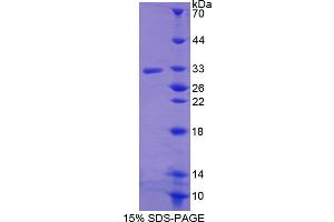 Image no. 1 for R-Spondin 3 (RSPO3) (AA 22-272) protein (His tag) (ABIN6236478) (R-Spondin 3 Protein (RSPO3) (AA 22-272) (His tag))