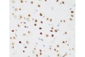 Immunohistochemistry of paraffin-embedded Mouse brain using CSRNP1 Polyclonal Antibody at dilution of 1:200 (40x lens). (AXUD1 抗体)