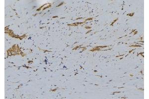 ABIN6276294 at 1/100 staining Human lung tissue by IHC-P. (BID 抗体  (C-Term))
