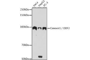Western blot analysis of extracts of various cell lines, using Cenexin1 / ODF2 antibody (ABIN1680357, ABIN3017873, ABIN3017874 and ABIN7101531) at 1:1000 dilution. (ODF2 抗体)