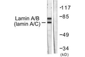 Western blot analysis of extracts from HeLa cells, using Lamin A/C (Ab-392) Antibody. (Lamin A/C 抗体  (AA 361-410))
