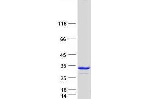 Western Blotting (WB) image for Proteasome (Prosome, Macropain) 26S Subunit, Non-ATPase, 9 (PSMD9) protein (Myc-DYKDDDDK Tag) (ABIN2730008)