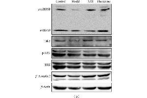 Representative Western blot analysis (a) and immunohistochemical staining (b) of BDNF, TrkB, p-ERK, ERK, and β-arrestin 2 in the hippocampus. (TRKB 抗体  (AA 401-500))