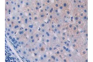 Used in DAB staining on fromalin fixed paraffin- embedded stomach tissue (IL18R1 抗体  (AA 147-255))