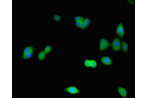 Immunofluorescence staining of HepG2 cells with ABIN7148865 at 1:266, counter-stained with DAPI. (CDK2 抗体  (AA 1-298))