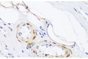 Immunohistochemistry of paraffin-embedded Human appendix using Phospho-PLN(T17) Polyclonal Antibody at dilution of 1:100 (40x lens). (Phospholamban 抗体  (pThr17))