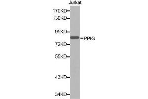 Western blot analysis of extracts of Jurkat cell line, using PPIG antibody. (PPIG 抗体  (AA 1-100))