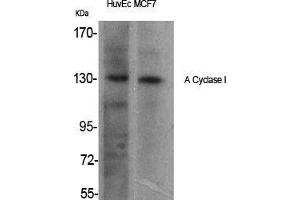 Western Blot (WB) analysis of specific cells using A Cyclase I Polyclonal Antibody. (ADCY1 抗体  (Internal Region))
