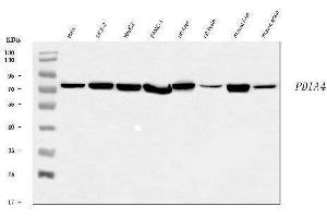 Western blot analysis of ERp72/PDIA4 using anti-ERp72/PDIA4 antibody (ABIN7602103).