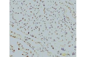 IHC analysis of RPA32/RPA2 using anti-RPA32/RPA2 antibody (ABIN7601379). (RPA2 抗体  (AA 34-254))