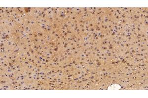 Immunohistochemistry (IHC) image for anti-Enolase 2 (Gamma, Neuronal) (ENO2) (AA 2-434) antibody (ABIN7437980)