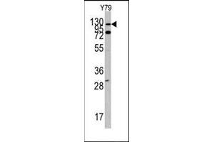 Image no. 1 for anti-C-Abl Oncogene 1, Non-Receptor tyrosine Kinase (ABL1) (N-Term) antibody (ABIN359967) (ABL1 抗体  (N-Term))