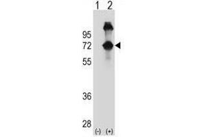 Western blot analysis of ASPSCR1 (arrow) using rabbit polyclonal ASPSCR1 Antibody (N-term) . (ASPSCR1 抗体  (N-Term))