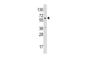 Western blot analysis of anti-CYP19A1 Pab (ABIN391826 and ABIN2841671) in Jurkat cell line lysates (35 μg/lane). (Aromatase 抗体  (C-Term))