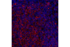 Immunofluorescence (IF) image for anti-HLA-DR (HLA-DR) antibody (ABIN7449537) (HLA-DR 抗体)