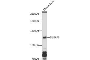 Western blot analysis of extracts of Mouse brain, using DLG antibody (ABIN7266791) at 1:1000 dilution. (DLGAP3 抗体  (AA 1-100))