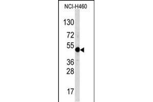 Western blot analysis of TFA Antibody (C-term) (ABIN388694 and ABIN2838770) in NCI- cell line lysates (35 μg/lane).