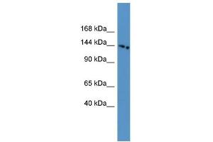 WB Suggested Anti-SLC4A5 Antibody Titration: 0. (NBC4 抗体  (N-Term))