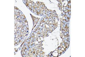 Immunohistochemistry (IHC) image for anti-Receptor (G Protein-Coupled) Activity Modifying Protein 2 (RAMP2) (AA 1-145) antibody (ABIN3017321)