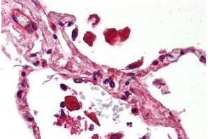Human Lung (formalin-fixed, paraffin-embedded) stained with STAT1 antibody ABIN239822 at 5 ug/ml followed by biotinylated anti-mouse IgG secondary antibody ABIN481714, alkaline phosphatase-streptavidin and chromogen. (STAT1 抗体)
