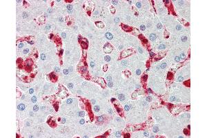 Anti-CFL1 / Cofilin antibody IHC staining of human liver. (Cofilin 抗体  (AA 4-32))
