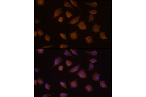 Immunofluorescence analysis of L929 cells using COMP Rabbit pAb (ABIN6127649, ABIN6138863, ABIN6138865 and ABIN6218152) at dilution of 1:100 (40x lens). (COMP 抗体  (AA 20-160))