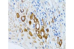 Immunohistochemistry of paraffin-embedded Human esophagus using PSRC1 Polyclonal Antibody at dilution of 1:100 (40x lens). (PSRC1 抗体)