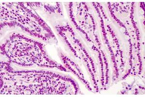 Immunohistochemistry (Formalin-fixed Paraffin-embedded Sections) (IHC (fp)) image for anti-Apurinic/Apyrimidinic Endonuclease 1 (APEX1) antibody (ABIN604870)