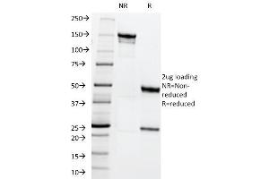 SDS-PAGE Analysis Purified MRP1 Mouse Monoclonal Antibody (MRP1/1344). (ABCC1 抗体)