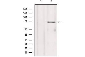 Western blot analysis of extracts from rat heart, using SYVN1 antibody. (SYVN1 抗体  (Internal Region))