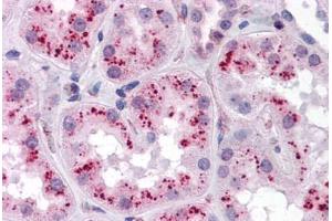 Human Kidney: Formalin-Fixed, Paraffin-Embedded (FFPE) (ZMYM4 抗体  (C-Term))