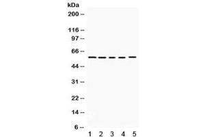 Western blot testing of 1) rat brain, 2) mouse brain, human 3) K562, 4) HeLa and 5) 22RV1 lysate with KCNA3 antibody. (KCNA3 抗体)