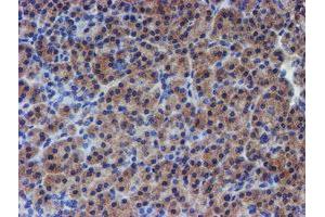 Immunohistochemical staining of paraffin-embedded Human pancreas tissue using anti-RPS6KB1 mouse monoclonal antibody. (RPS6KB1 抗体)
