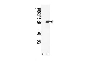 Western blot analysis of OPN-a/b (arrow) using rabbit polyclonal OPN-a/b Antibody (N-term) (ABIN655514 and ABIN2845029). (OPN-A,b (AA 14-40), (N-Term) 抗体)