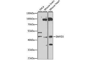 Western blot analysis of extracts of various cell lines, using SMYD3 antibody (ABIN6128709, ABIN6148169, ABIN6148170 and ABIN6223146) at 1:1000 dilution. (SMYD3 抗体  (AA 140-369))
