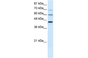 PRMT3 antibody used at 0. (PRMT3 抗体  (Middle Region))