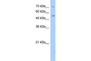 WB Suggested Anti-DPYS Antibody Titration:  2. (DPYS 抗体  (N-Term))