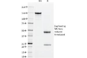 SDS-PAGE Analysis Purified Superoxide Dismutase 1 Mouse Monoclonal Antibody (SOD1/2089).