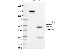 SDS-PAGE Analysis Purified Superoxide Dismutase 1 Mouse Monoclonal Antibody (SOD1/2089). (SOD1 抗体)